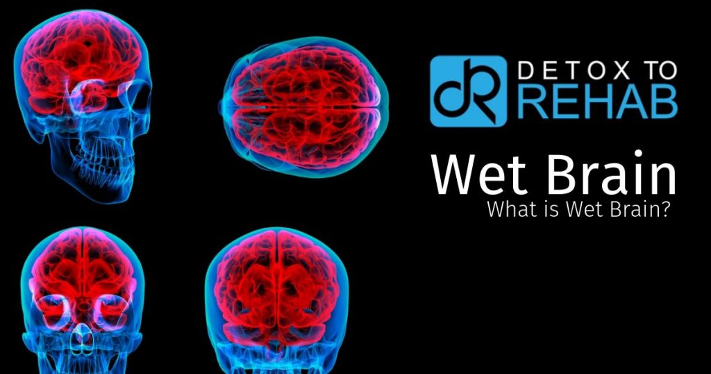 What is Wet Brain - Detox To Rehab
