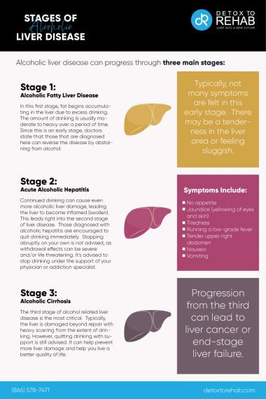 Official Symptoms Of Liver Disease Guide - Alcoholic And Non-alcoholic 