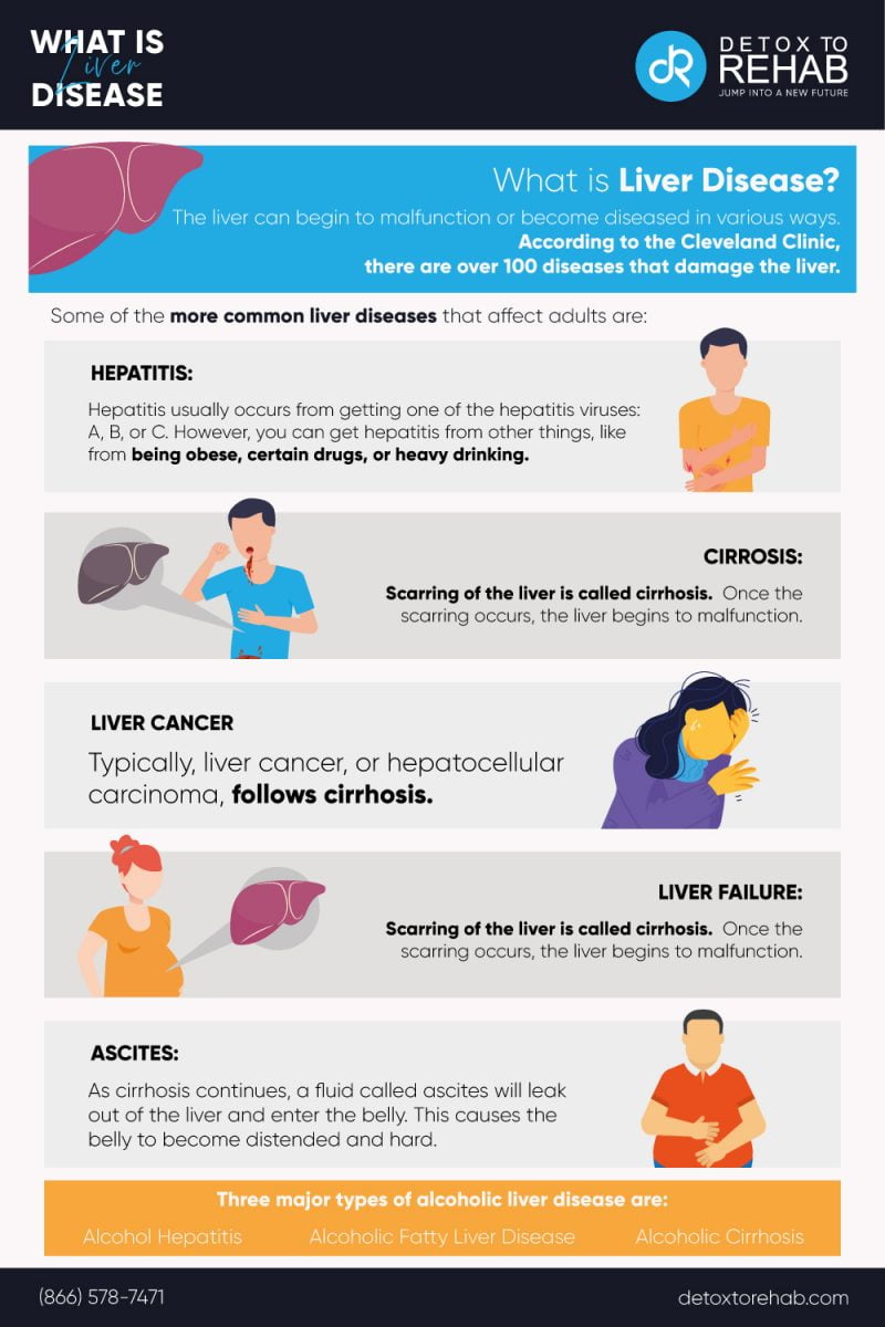 Official Symptoms Of Liver Disease Guide - Alcoholic And Non-Alcoholic ...