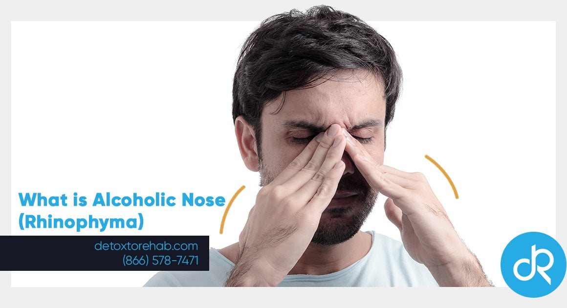 what is alcoholic nose header